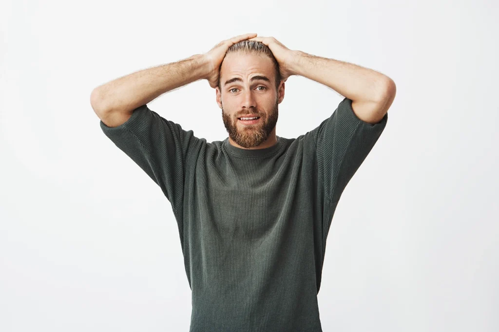 hair loss man